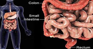 9 What is Colitis, and what are Treatment Options?